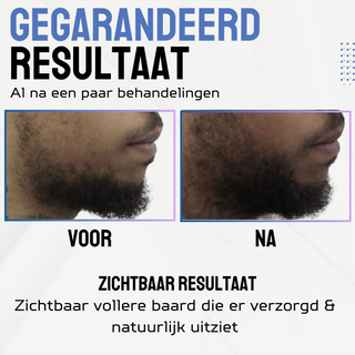 6 In 1 Dermaroller Baardgroei set